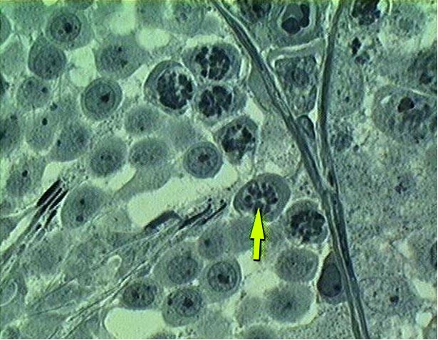 Επιλέχθηκε εικόνα